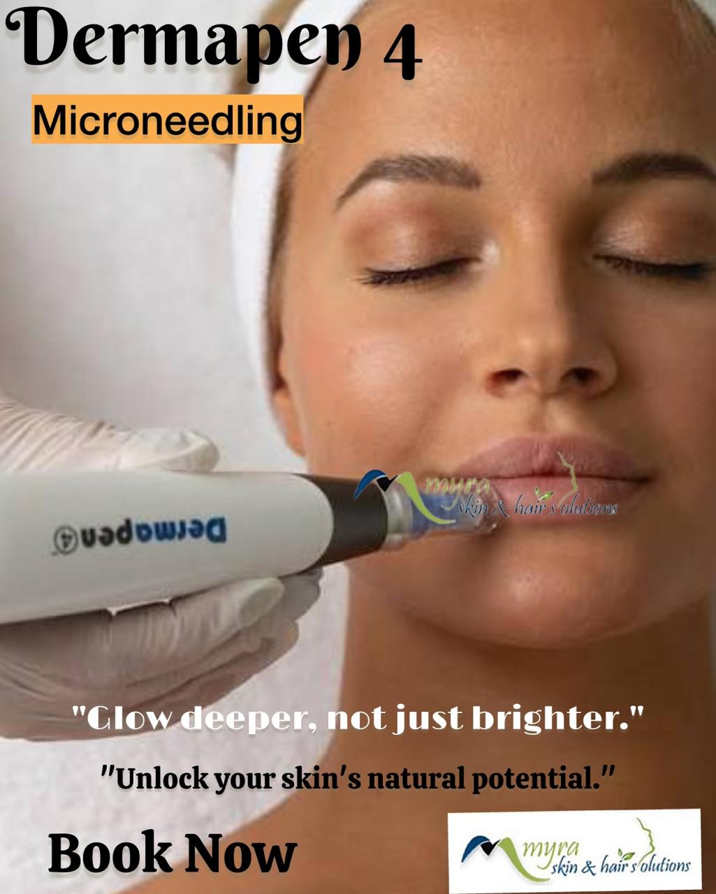 Microneedling