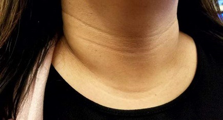 Neck