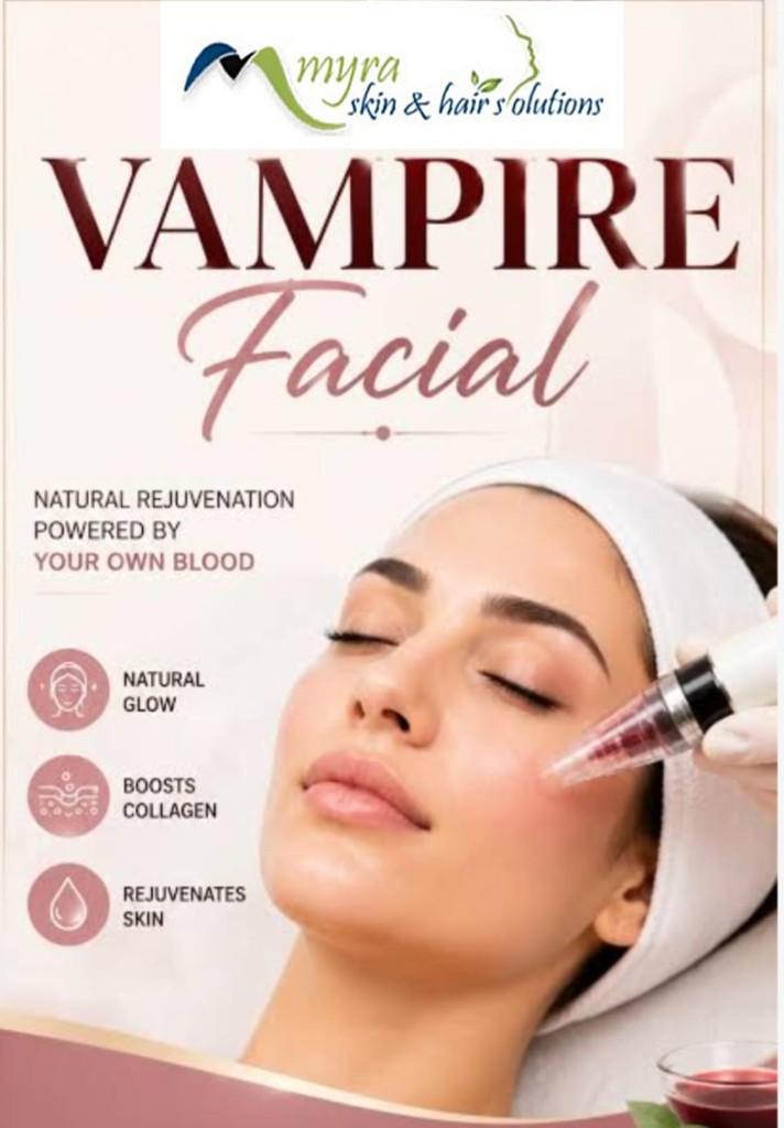 Vampire Facial Benefits