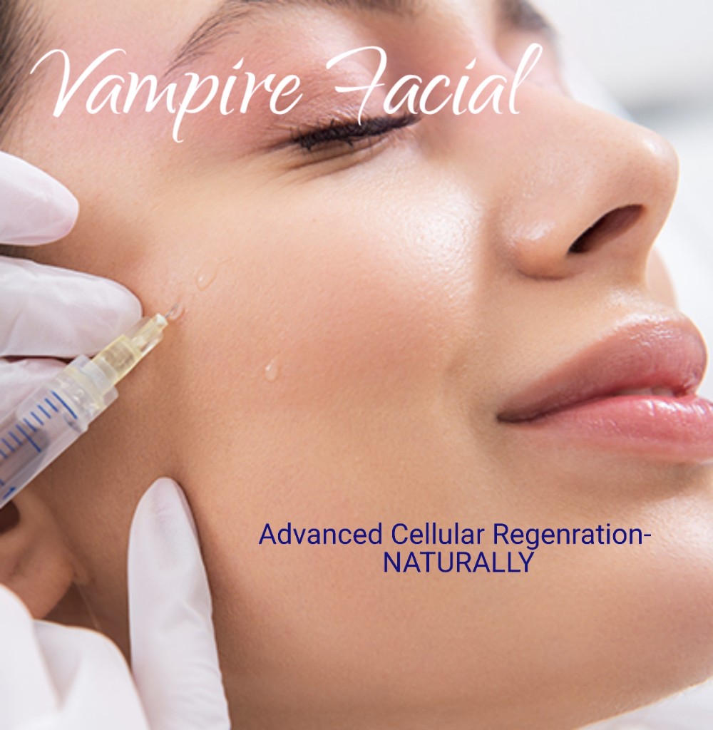 Vampire Facial Procedure